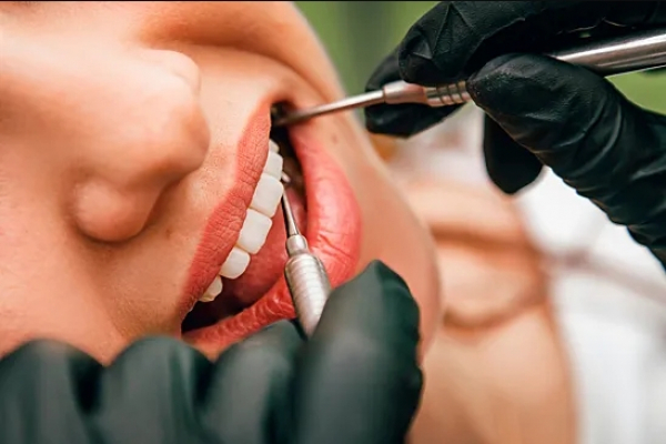 Лечение корневых каналов помогает снизить риск сердечных заболеваний и диабета