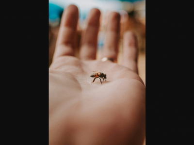 Укус пчелы может быть опасен для людей с гиперреакцией, даже без аллергии, предупреждает врач