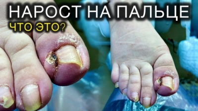Подолог посоветовала сушилку для обуви: весенняя грязь и пот грозят грибком без этого гаджета